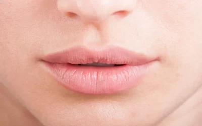 Transformación Sutil y Elegante: Aumento de Labios con Resultados Naturales