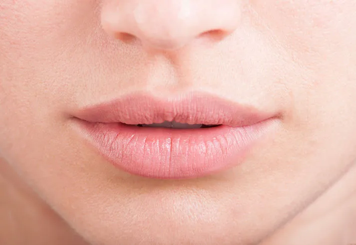 Transformación Sutil y Elegante: Aumento de Labios con Resultados Naturales