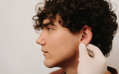 Masculinización facial con ácido hialurónico: Definición y armonía sin cirugía